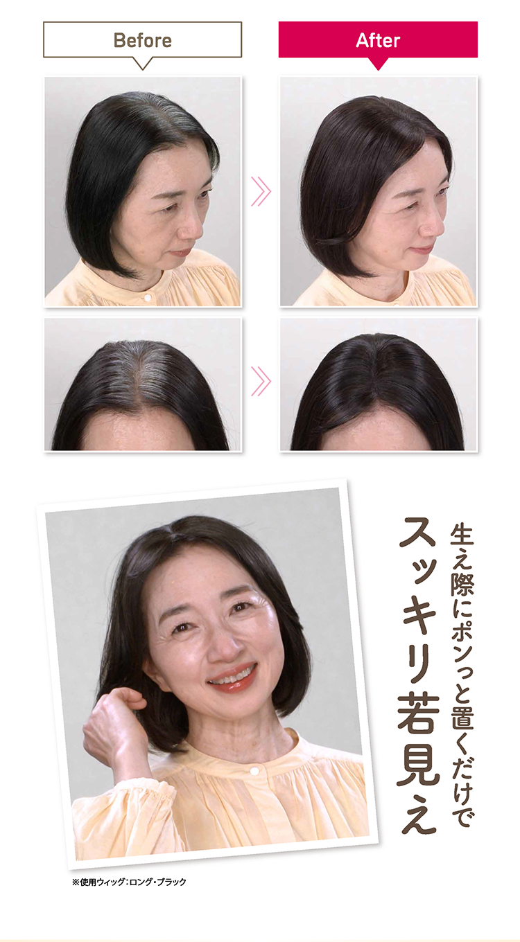 部分ウィッグ使用のビフォーアフター